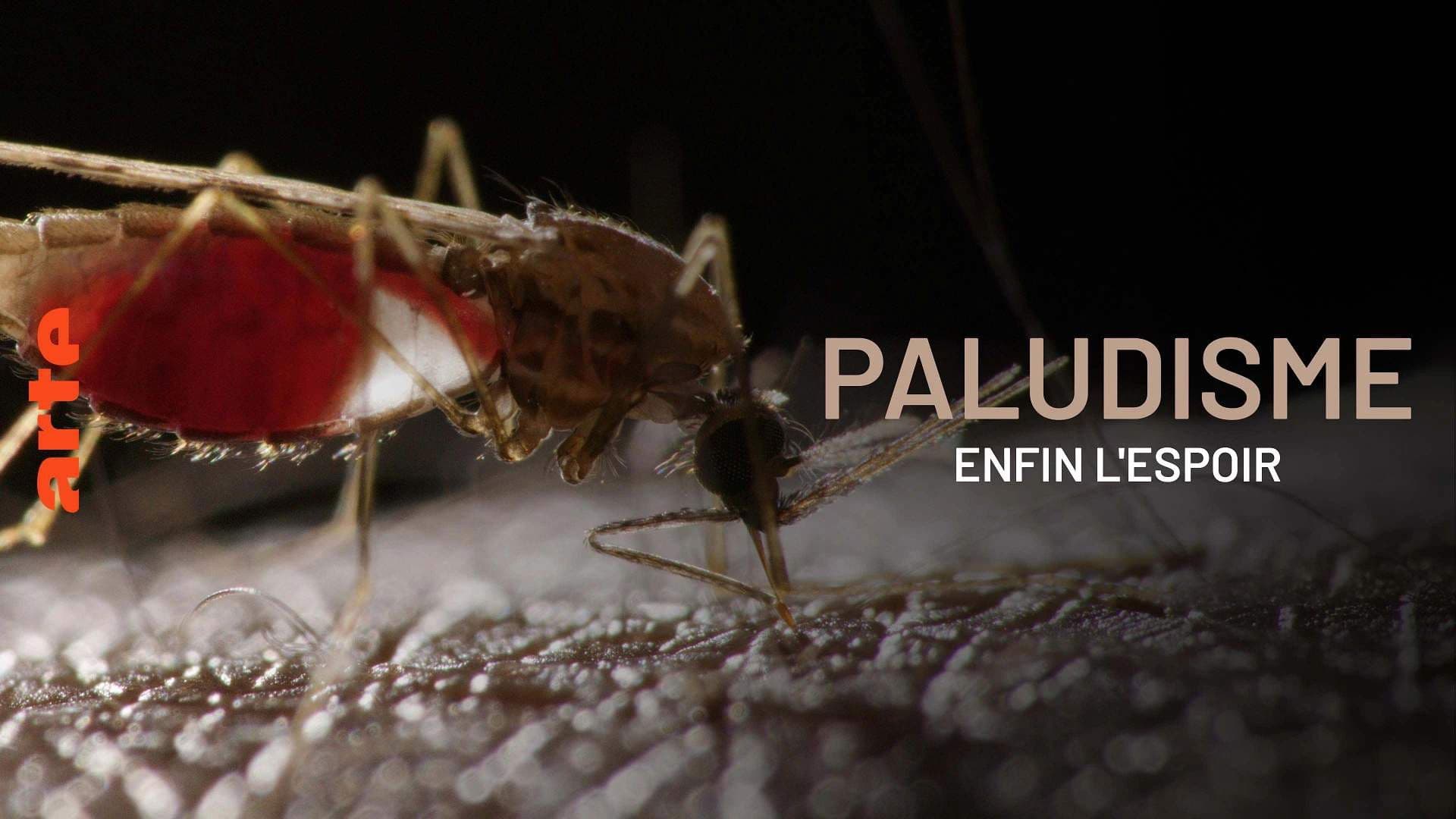 Poster backdrop for Paludisme, enfin l'espoir