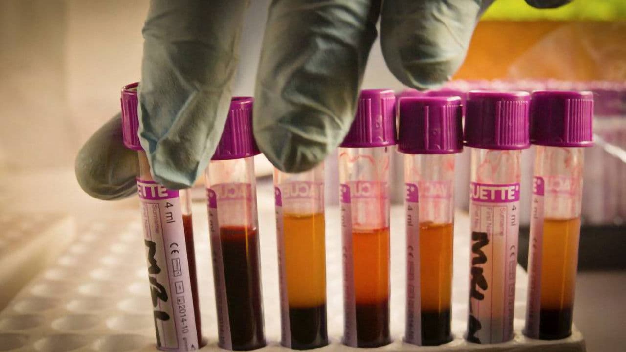 Poster backdrop for The Bloody Truth